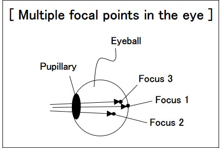 multiple focal points in eye