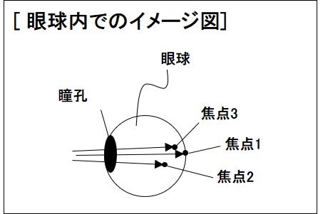 眼球内のイメージ